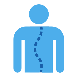 Scoliosis (abnormally curved spine)